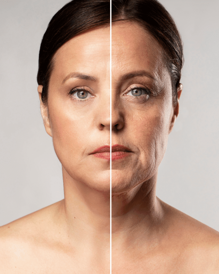 Bioestimulador de colágeno injetável